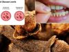 Cloves and Healthy Aging: Benefits and Precautions for People Over 50